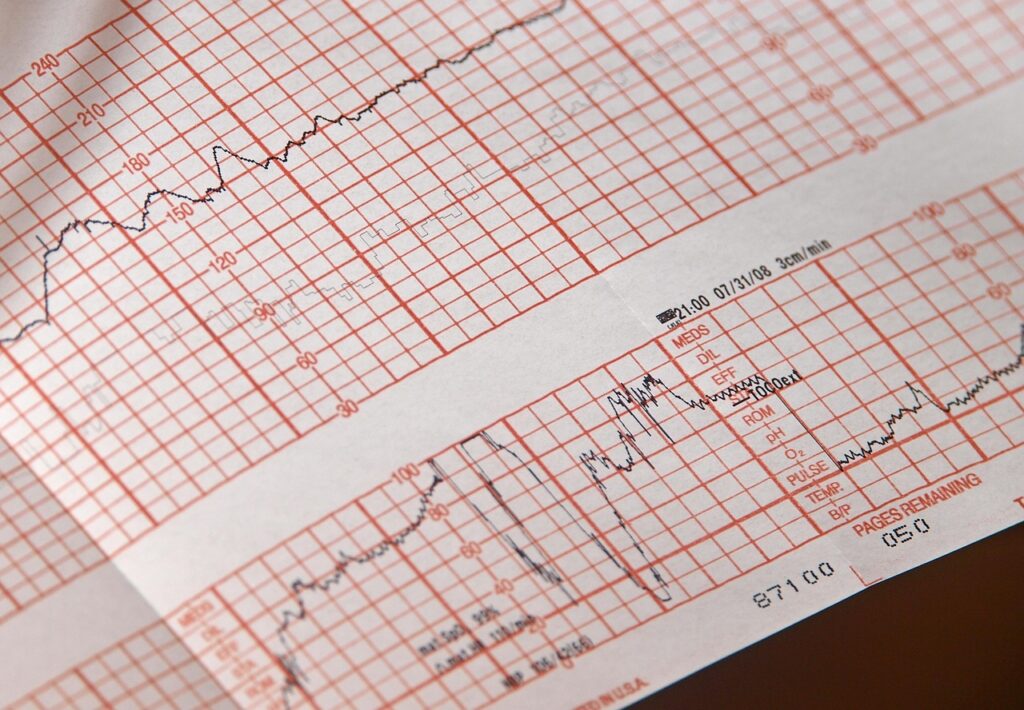 paper, textile, fabric, pattern, graph, plaid, print, bank check, document, tablecloth, dr, doctor, hospital, ekg, life, straight line, people, industry, calamity, expression, man, louisiana, new orleans, devastation, relief, gabriel raggio, raggio, ekg, ekg, ekg, ekg, ekg